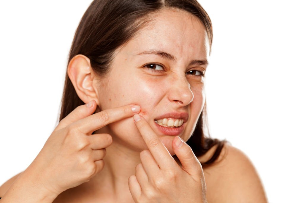 Read more about the article What Type of Acne Problem Do you Have