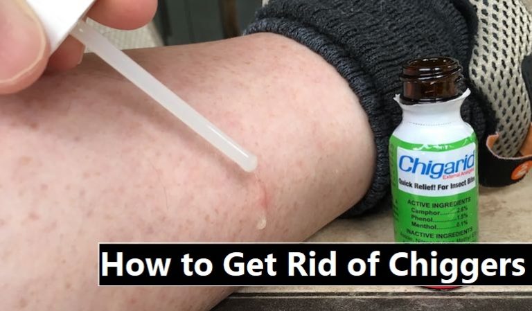 Read more about the article How to Get Rid of Chiggers