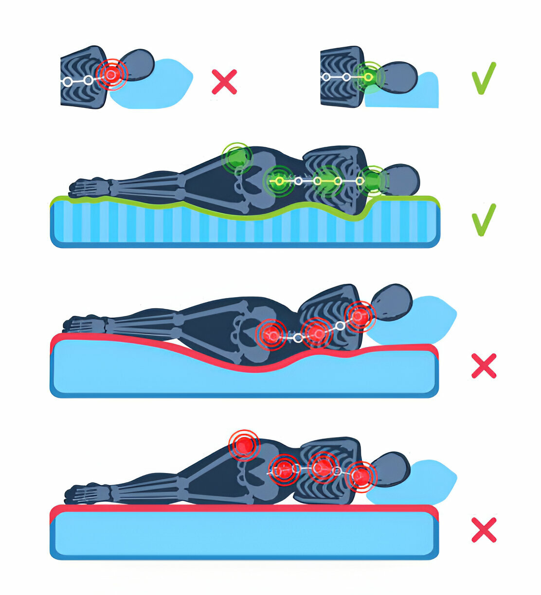 How Should I Sleep With Lower Back Pain?