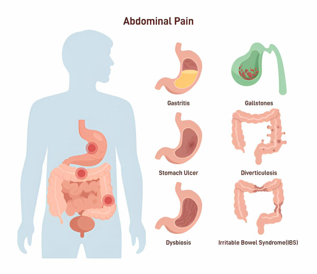 Vagueste Stomach Pain Symptoms